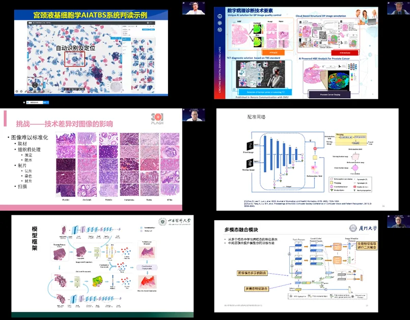 MICS Computational Pathology Special Topic and the Second Computational Pathology Symposium were successfully held