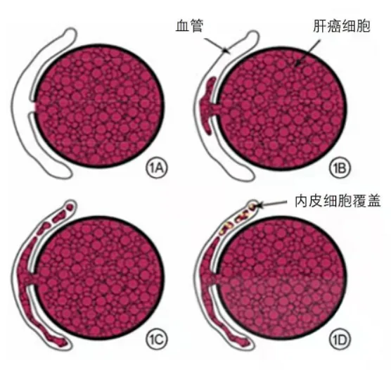 The paper jointly written by Zhou Zhenghao, a graduate student at the Smart Medical Research Institute, and Dr. Xia Yi from CUHK Hospital was accepted by Radiology, the top journal in the field of medical imaging.