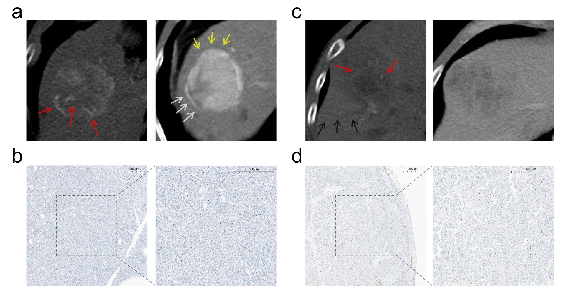 The paper jointly written by Zhou Zhenghao, a graduate student at the Smart Medical Research Institute, and Dr. Xia Yi from CUHK Hospital was accepted by Radiology, the top journal in the field of medical imaging.