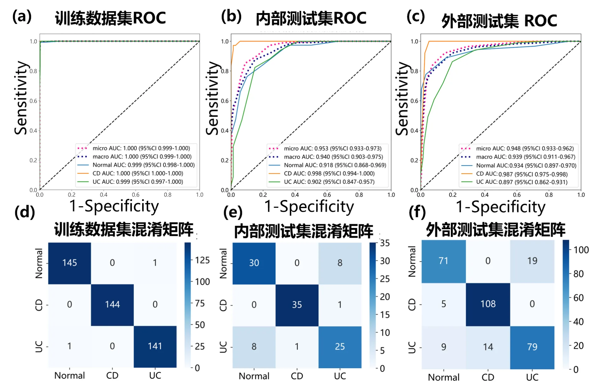 The intelligent diagnosis model based on biopsy pathology developed by Dr. Chengfei Cai of IMIC Lab can significantly improve the clinical diagnosis efficiency of inflammatory bowel disease.