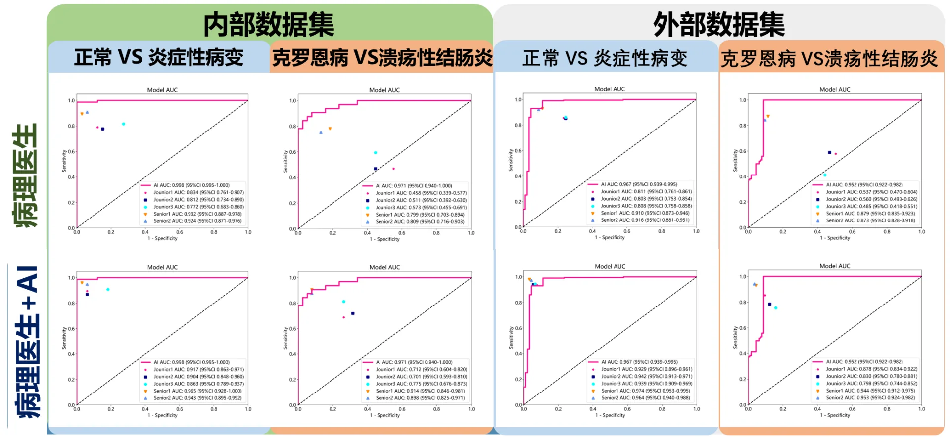 The intelligent diagnosis model based on biopsy pathology developed by Dr. Chengfei Cai of IMIC Lab can significantly improve the clinical diagnosis efficiency of inflammatory bowel disease.