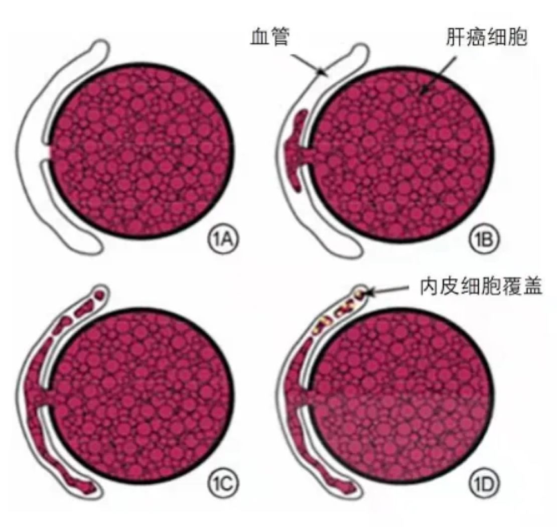 The paper jointly written by Zhou Zhenghao, a graduate student at the Smart Medical Research Institute, and Dr. Xia Yi from CUHK Hospital was accepted by Radiology, the top journal in the field of medical imaging.