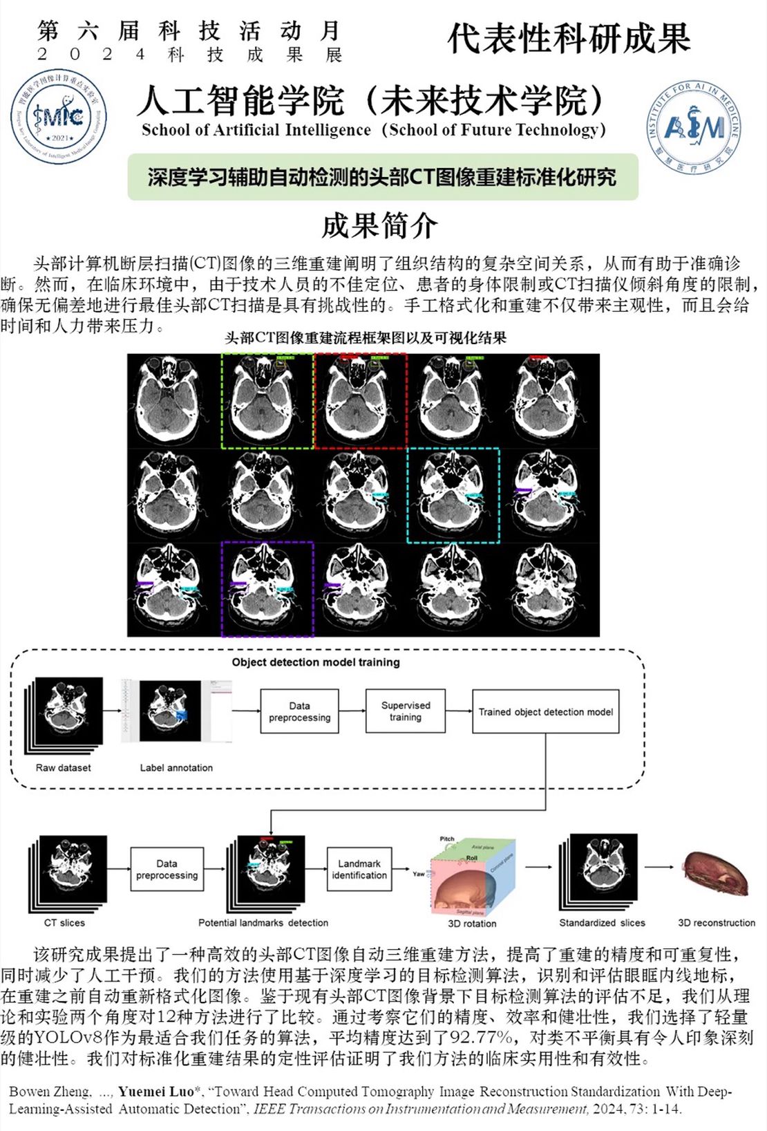 Research on standardization of head CT image reconstruction for deep learning-assisted automatic detection