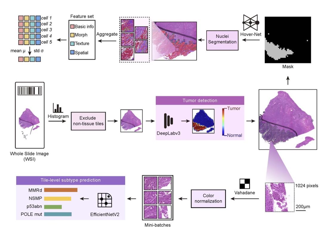 A collaborative paper between IMIC Lab and Fudan University Cancer Hospital was published in the collaborative journal npj Precision Oncology in Nature