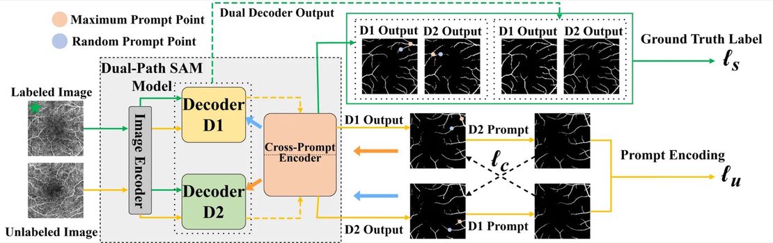 The paper of Professor Luo Yuemei’s research group from IMIC Lab was published in the international authoritative journal Applied Soft Computing