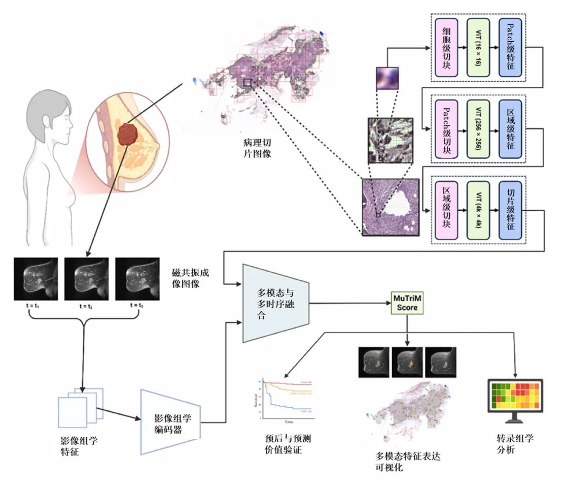 The paper of Wang Xiangxue’s research group from the IMIC laboratory was published in the internationally authoritative European Journal of Cancer